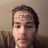 FOREHEAD